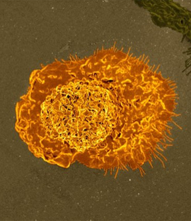 Macrophages can eat leukemia cancer cells when the cells are exposed to anti-CD47 antibodies.