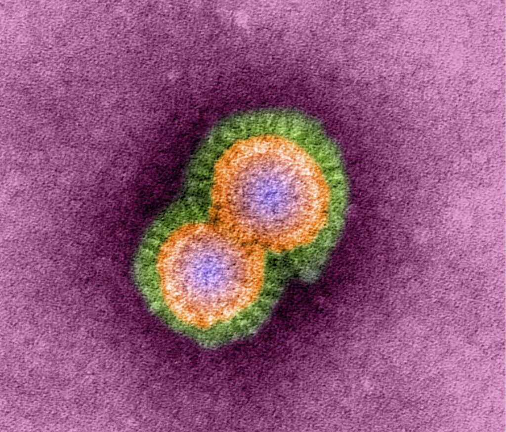H5N1 avian influenza virus particles, coloured transmission electron micrograph (TEM). Each virus particle consists of ribonucleic acid (RNA), surrounded by a nucleocapsid and a lipid envelope (green). The natural hosts of this virus are wild birds, which show few symptoms. However, infected domestic birds suffer a 90-100% mortality rate. Humans that have contact with infected birds can become infected. The first such infection was identified in South-East Asia in 1997, and the virus has steadily spread across the world, with an outbreak in a poultry farm in the UK in 2007. There are fears that the virus may mutate into a human-transmissible form, which could lead to millions of deaths worldwide. Magnification: x670,000 when printed 10cm wide.