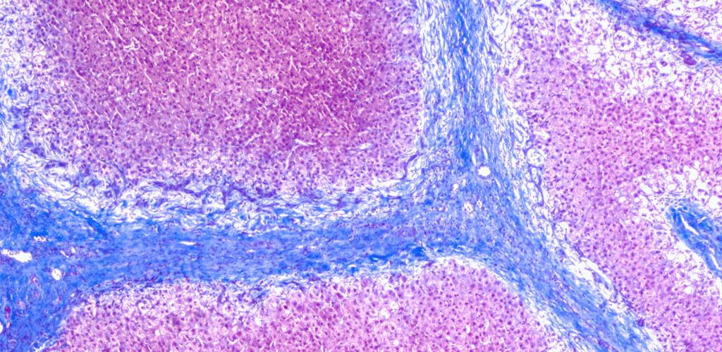 A shot taken under a microscope.